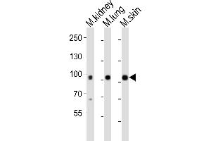 Western blot analysis of lysates from mouse kidney, mouse lung, mouse skin tissue (from left to right), using Epha1 Antibody (N-term) (ABIN6242303 and ABIN6577697). (EPHA1 抗体  (N-Term))