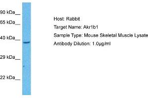 Host: Mouse Target Name: AKR1B1 Sample Tissue: Mouse Skeletal Muscle Antibody Dilution: 1ug/ml (AKR1B1 抗体  (N-Term))