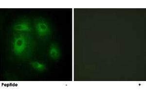 Immunofluorescence analysis of HeLa cells, using DLEC1 polyclonal antibody .