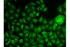 Immunofluorescence analysis of MCF-7 cell using CTTN antibody.