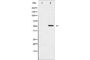 Western blot analysis of Src expression in HeLa whole cell lysates,The lane on the left is treated with the antigen-specific peptide. (Src 抗体  (N-Term))