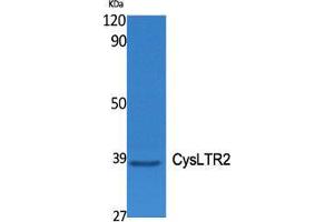 Western Blot (WB) analysis of specific cells using CysLTR2 Polyclonal Antibody. (CasLTR2 抗体  (C-Term))
