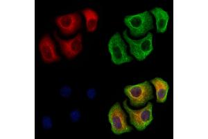ABIN6265355 and ABIN6279867 staining Hela cells by IF/ICC.