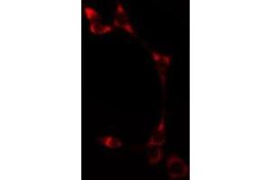ABIN6275513 staining  HT29 cells by IF/ICC. (ATP2A1/SERCA1 抗体  (Internal Region))