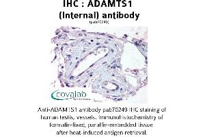 Image no. 1 for anti-ADAM Metallopeptidase with Thrombospondin Type 1 Motif, 1 (ADAMTS1) (Internal Region) antibody (ABIN1731522) (ADAMTS1 抗体  (Internal Region))