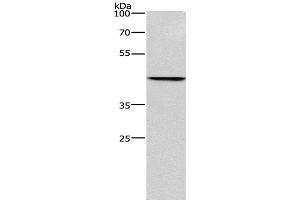 Western Blot analysis of Hela cell using BGN Polyclonal Antibody at dilution of 1:550 (Biglycan 抗体)