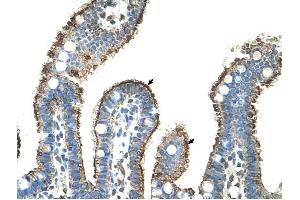 MMP1 antibody was used for immunohistochemistry at a concentration of 4-8 ug/ml to stain Epithelial cells of intestinal villus (arrows) in Human Intestine. (MMP1 抗体)