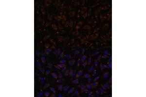 Immunofluorescence analysis of L929 cells using PLLP antibody (ABIN7269390) at dilution of 1:100. (Plasmolipin 抗体  (AA 1-100))