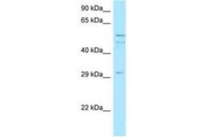 Image no. 1 for anti-Chromosome 11 Open Reading Frame 42 (C11ORF42) (AA 259-308) antibody (ABIN6747983) (C11ORF42 抗体  (AA 259-308))