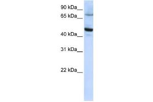 Western Blotting (WB) image for anti-Cytochrome P450, Family 46, Subfamily A, Polypeptide 1 (CYP46A1) antibody (ABIN2458770) (CYP46A1 抗体)