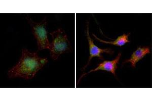 Immunofluorescence analysis of A549 (left) and SK-BR-3 (right) cells using CTNNB1 mouse mAb (green).