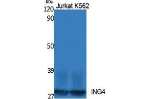 Western Blotting (WB) image for anti-Inhibitor of Growth Family, Member 4 (ING4) (Internal Region) antibody (ABIN3187605)