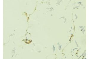 ABIN6276785 at 1/100 staining Human lung tissue by IHC-P. (OLR1 抗体  (N-Term))