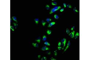 Immunofluorescence staining of Hela cells with ABIN7171142 at 1:66, counter-stained with DAPI. (SNAP23 抗体  (AA 90-196))