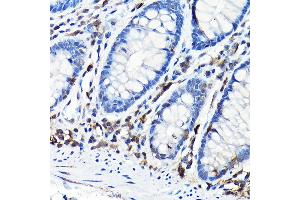 Immunohistochemistry of paraffin-embedded mouse spleen using NLRP1 Rabbit pAb (ABIN7268935) at dilution of 1:100 (40x lens). (NLRP1 抗体  (AA 1000-1100))
