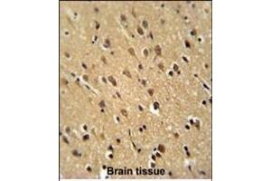 Immunohistochemistry (Paraffin-embedded Sections) (IHC (p)) image for anti-Phosphoribosylformylglycinamidine Synthase (PFAS) (AA 184-213), (N-Term) antibody (ABIN650947)