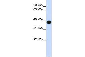 WB Suggested Anti-DEGS1 Antibody Titration:  0. (DEGS1 抗体  (N-Term))