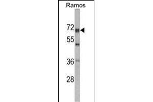 Western blot analysis of DDX5 antibody (Center) (ABIN391669 and ABIN2841580) in Romas cell line lysates (35 μg/lane). (DDX5 抗体  (AA 306-334))