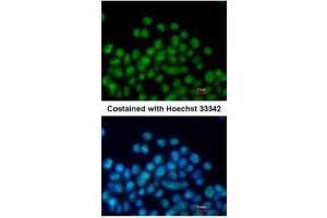 ICC/IF Image Immunofluorescence analysis of paraformaldehyde-fixed mouse ESC D3, using Nkx2. (NK2 Homeobox 5 抗体)