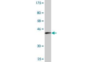 Western Blot detection against Immunogen (36. (ENAH 抗体  (AA 291-390))
