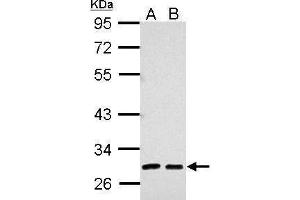WB Image Sample (30 ug of whole cell lysate) A: 293T B: A431 10% SDS PAGE antibody diluted at 1:5000 (AMBP 抗体)
