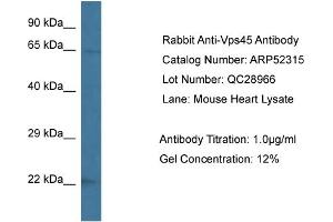 Western Blotting (WB) image for anti-Vacuolar Protein Sorting 45 (VPS45) (C-Term) antibody (ABIN2784878) (VPS45 抗体  (C-Term))