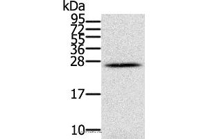 Western blot analysis of Human ovarian cancer, using IFNL3 Polyclonal Antibody at dilution of 1:350 (IL28B 抗体)