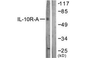 Western blot analysis of extracts from HepG2 cells, treated with Na2VO3 0. (IL-10RA 抗体  (AA 462-511))