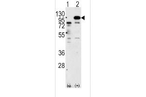 Western blot analysis of P (arrow) using rabbit polyclonal P Antibody (C-term) 6306b. (APP 抗体  (C-Term))