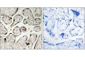 Immunohistochemistry analysis of paraffin-embedded human placenta tissue, using GIMAP5 Antibody. (GIMAP5 抗体  (AA 231-280))