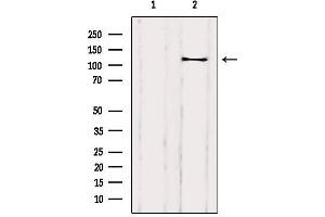 Western blot analysis of extracts from Rat heart, using DAAM1 Antibody. (DAAM1 抗体  (Internal Region))