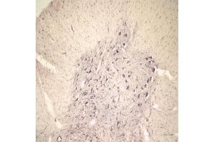 IHC on rat spinal cord using Rabbit antibody to extracellular, N-terminal part of Sortilin (Neurotensin receptor 3, NTR3, Sort1): IgG (ABIN350868) at a concentration of 10 µg/ml.