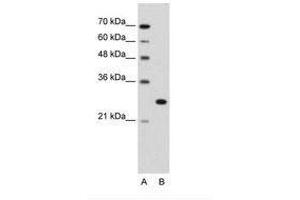 Image no. 2 for anti-Forkhead Box R2 (FOXR2) (AA 82-131) antibody (ABIN203387) (FOXR2 抗体  (AA 82-131))