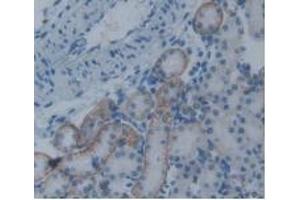 Detection of PAI2 in Rat Kidney Tissue using Monoclonal Antibody to Plasminogen Activator Inhibitor 2 (PAI2) (SERPINB2 抗体  (AA 154-408))