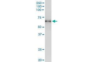 Immunoprecipitation of STK17A transfected lysate using anti-STK17A MaxPab rabbit polyclonal antibody and Protein A Magnetic Bead , and immunoblotted with STK17A MaxPab mouse polyclonal antibody (B01) . (STK17A 抗体  (AA 1-414))