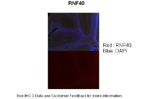 Sample Type :  Adult mouse cerebellum (l0x) section  Primary Antibody Dilution :  1:100  Secondary Antibody :  Donkey Anti-rabbit (568 nm)  Secondary Antibody Dilution :  1:500  Color/Signal Descriptions :  RNF40: Red DAPI:Blue  Gene Name :  RNF40  Submitted by :  Anonymous (RNF40 抗体  (C-Term))