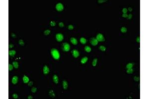 Immunofluorescent analysis of HepG2 cells using ABIN7156655 at dilution of 1:100 and Alexa Fluor 488-congugated AffiniPure Goat Anti-Rabbit IgG(H+L) (IFI44 抗体  (AA 101-300))