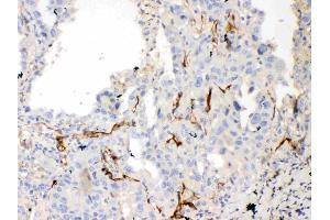 IHC analysis of Bcl-XL using anti-Bcl-XL antibody . (BCL2L1 抗体  (AA 1-219))