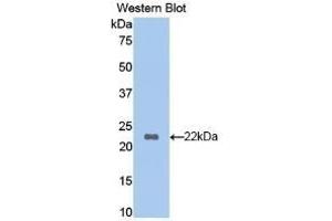 Detection of Recombinant HBb, Mouse using Polyclonal Antibody to Hemoglobin Beta (HBb) (Hemoglobin Subunit beta 抗体  (AA 1-147))