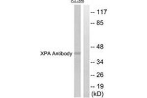 Western blot analysis of extracts from COLO205 cells, using XPA Antibody. (PA (AA 211-260) 抗体)