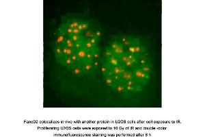 Image no. 4 for anti-Fanconi Anemia, Complementation Group D2 (FANCD2) (N-Term) antibody (ABIN363390)