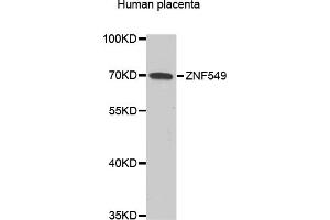 Western blot analysis of extracts of Human placenta, using ZNF549 antibody (ABIN6293799) at 1:1000 dilution. (ZNF549 抗体)