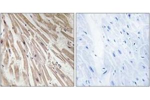 Immunohistochemistry analysis of paraffin-embedded human heart tissue, using ARPP21 Antibody. (ARPP21 抗体  (AA 211-260))