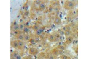 IHC-P analysis of Liver tissue, with DAB staining. (OLR1 抗体  (AA 60-312))