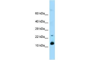 Western Blotting (WB) image for anti-Regenerating Islet-Derived 1 (REG1) (Middle Region) antibody (ABIN2789530) (REG1 抗体  (Middle Region))