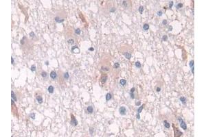 Immunohistochemistry (IHC) image for anti-Proteasome (Prosome, Macropain) 26S Subunit, Non-ATPase, 2 (PSMD2) (AA 645-872) antibody (ABIN7439738)