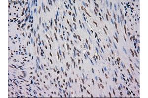 Immunohistochemical staining of paraffin-embedded Carcinoma of kidney tissue using anti-MRI1mouse monoclonal antibody. (MRI1 抗体)