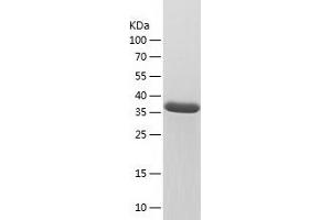 Western Blotting (WB) image for Ectonucleoside Triphosphate diphosphohydrolase 1 (ENTPD1) (AA 70-197) protein (His-IF2DI Tag) (ABIN7122738) (CD39 Protein (AA 70-197) (His-IF2DI Tag))