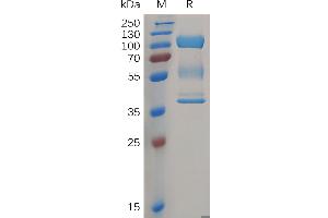 SDS-PAGE (SDS) image for Zona Pellucida Glycoprotein 3 (ZP3) (AA 23-386) protein (Fc Tag) (ABIN6964410)