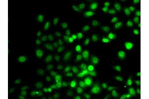 Immunofluorescence analysis of A549 cell using PRDM7 antibody. (PRDM7 抗体)